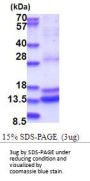 Human Caspase-2 Recombinant Protein