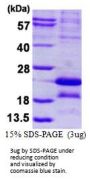 Human MAGEA5 Recombinant Protein