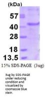 Human MAGEA6 Recombinant Protein
