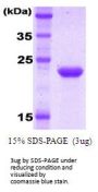 Human KIR2DL1/CD158a Recombinant Protein