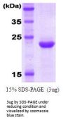 Human KIR2DL3/CD158b2 Recombinant Protein