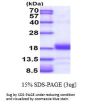 Human KIR3DL1 Recombinant Protein