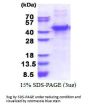 Human MMP-13 Recombinant Protein