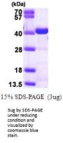 Human CrkL Recombinant Protein