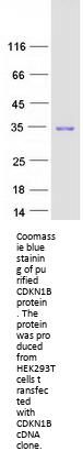 p27 KIP 1 (CDKN1B) (NM_004064) Human Recombinant Protein