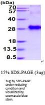 Mouse IGFBP-6 Recombinant Protein