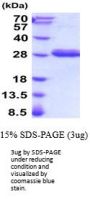 Rat C-Reactive Recombinant Protein/CRP Recombinant Protein