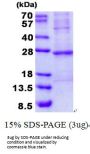 Human TNNI2 Recombinant Protein