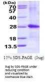 Human ARL4D Recombinant Protein