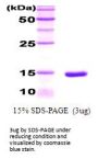 Human CEBP alpha Recombinant Protein