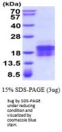 Human VEGF-C Recombinant Protein
