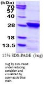Human RGS4 Recombinant Protein