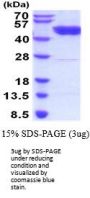 Human GSK-3 beta Recombinant Protein
