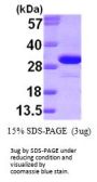 Human Ketohexokinase Recombinant Protein