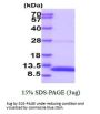 Mouse S100B Recombinant Protein