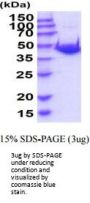 Mouse Ahcy Recombinant Protein