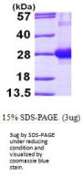 Human Rab7a Recombinant Protein