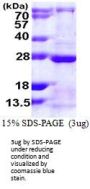 Human Rab13 Recombinant Protein