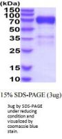 Human Glypican 3 Recombinant Protein
