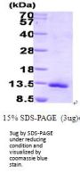 Human CCL11/Eotaxin Recombinant Protein