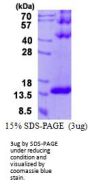 Human DYNLT3 Recombinant Protein