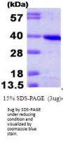 Human Cyclin H Recombinant Protein