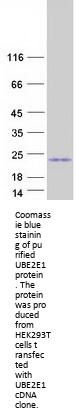 UBE2E1 (NM_182666) Human Recombinant Protein