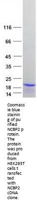 NCBP2 (NM_001042540) Human Recombinant Protein