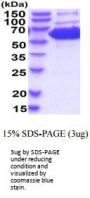 Mouse Pkm Recombinant Protein