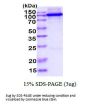 Human Hexokinase 2 Recombinant Protein