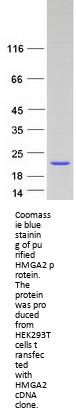 HMGA2 (NM_003484) Human Recombinant Protein