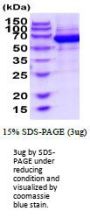 Mouse EphB4 Recombinant Protein