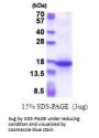 Human MFAP3 Recombinant Protein