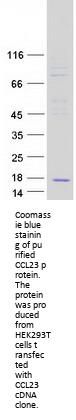 Macrophage Inflammatory Protein 3 (CCL23) (NM_145898) Human Recombinant Protein
