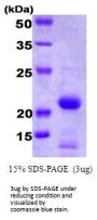 Human BID Recombinant Protein