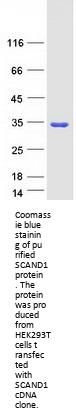 SCAND1 (NM_033630) Human Recombinant Protein