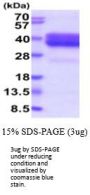Human Neurexophilin-1/NXPH1 Recombinant Protein