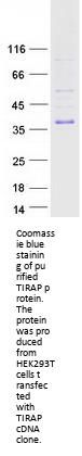 TIRAP (NM_001039661) Human Recombinant Protein