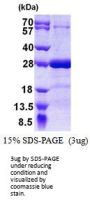 Human SNAP25 Recombinant Protein