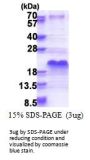 Human SHFM1 Recombinant Protein
