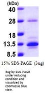 Human S100A10 Recombinant Protein