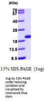 Human GMF-beta Recombinant Protein