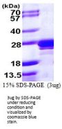 Human RAB2A Recombinant Protein