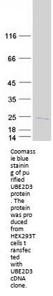UBE2D3 (NM_003340) Human Recombinant Protein