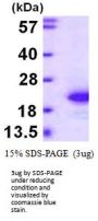 Mouse FGF1 Recombinant Protein
