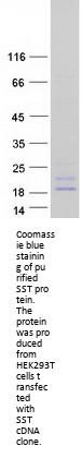 Somatostatin (SST) (NM_001048) Human Recombinant Protein