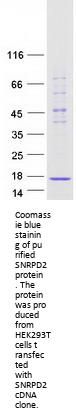 SNRPD2 (NM_004597) Human Recombinant Protein