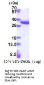 Human RPS4X Recombinant Protein