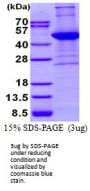 Human ACTA2 Recombinant Protein