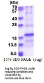 Human RPL31 Recombinant Protein